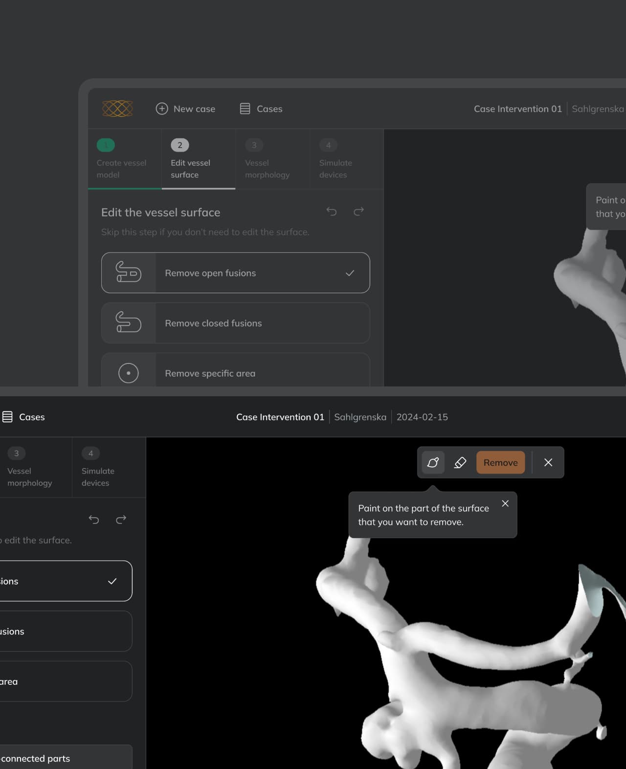 The Ankyras editing mode with the toolbar placed in the 3D view next to the model